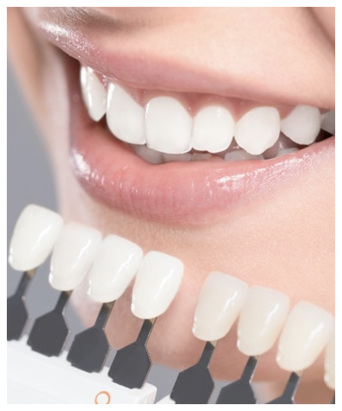 Estetica Dentale